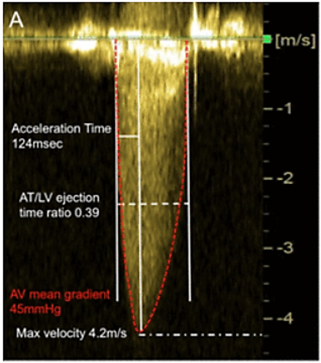 <p>Acceleration time</p>