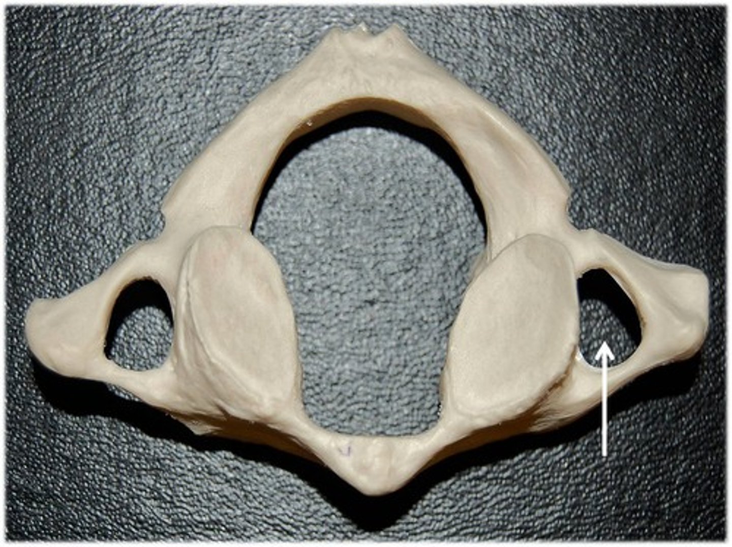 <p>vertebral arteries pass through to the brain; found only in cervical vertebrae</p>