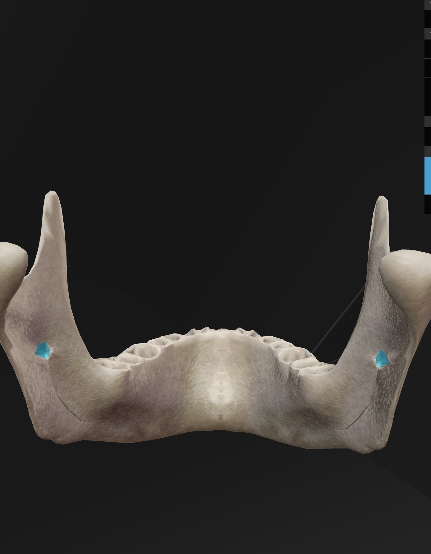 <p>What is the name for this bone and bone landmark, what does the landmark do?</p>