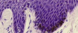 <p>Stratum basale</p>