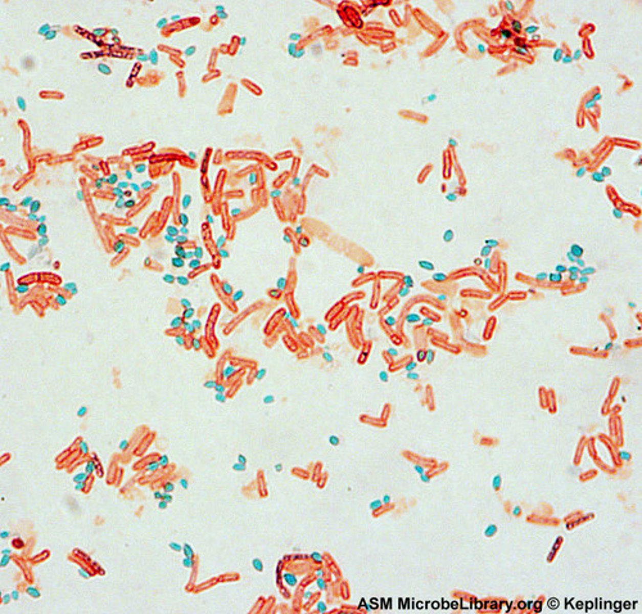 <p>A differential stain used to detect the presence and location of spores in bacterial cells.</p>