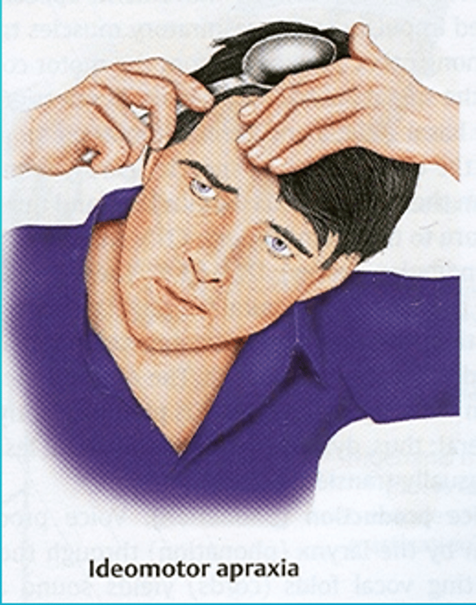 <p>the inability to carry out a simple motor activity in response to a verbal command, even though this same activity is readily performed spontaneously when provided with the object</p><p>Has the motor ability to do the task but not on command and only on their own</p>