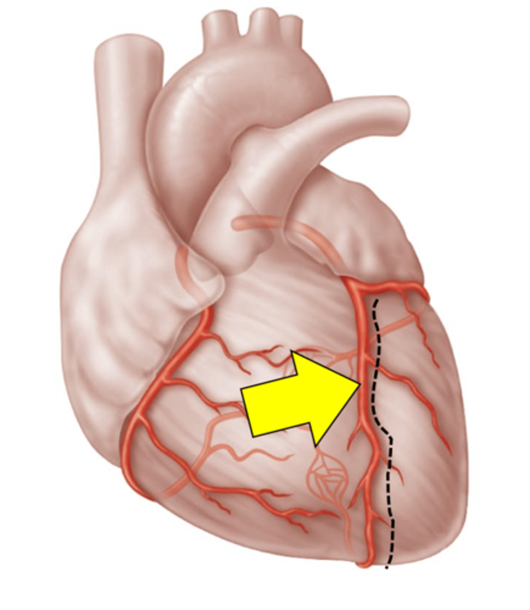 <p>Name the red vessel.</p>