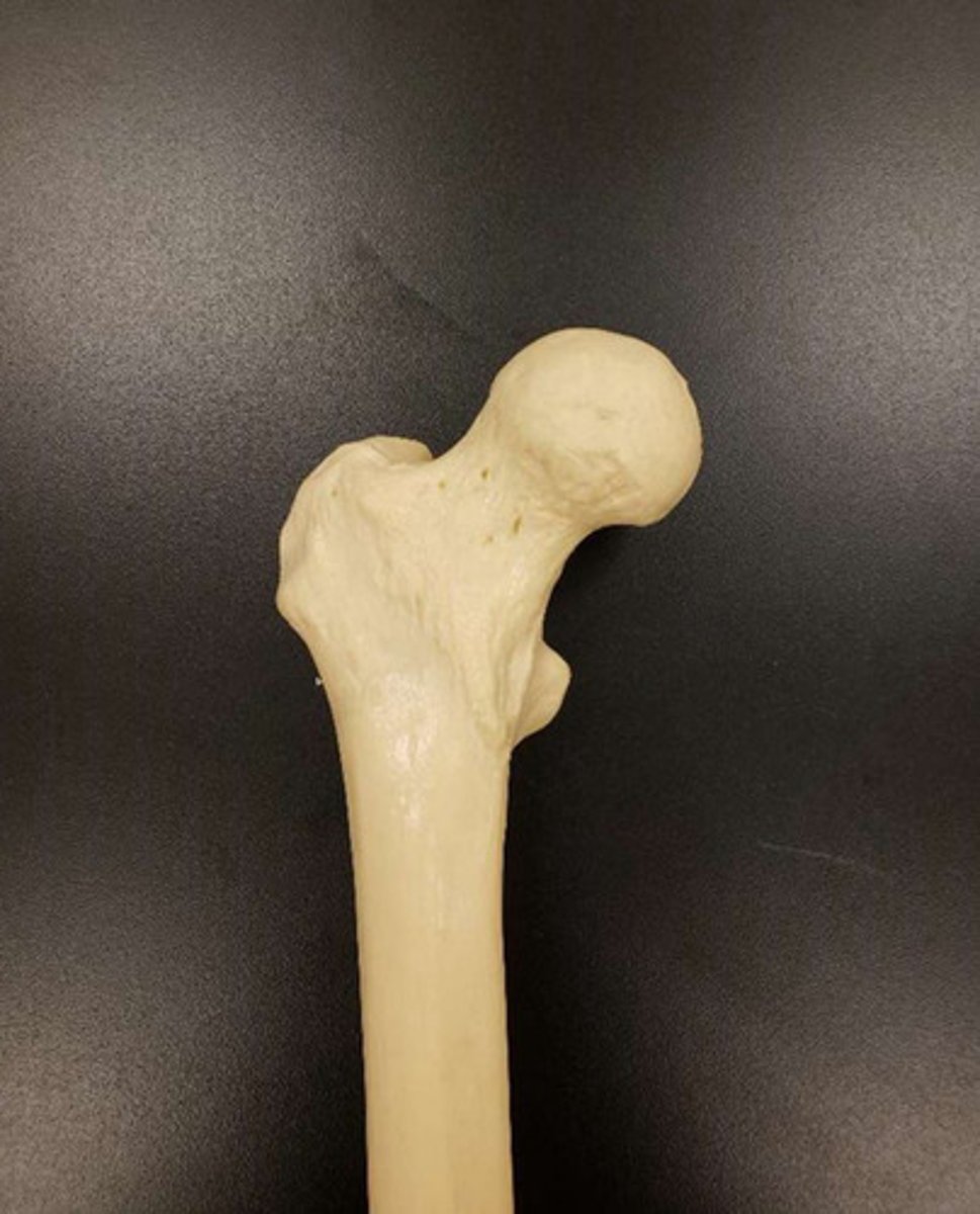 <p>anterior/posterior proximal/distal of the femur</p>