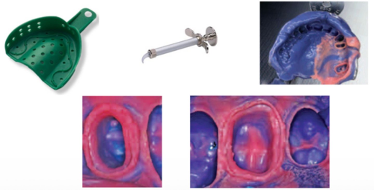 <p>What technique is shown?</p><p>- Tray Material — Medium or Heavy Viscosity</p><p>- Syringe Material — Low or Medium viscosity</p><p>- Use simultaneously (nick name Putty-Wash impression tech)</p>