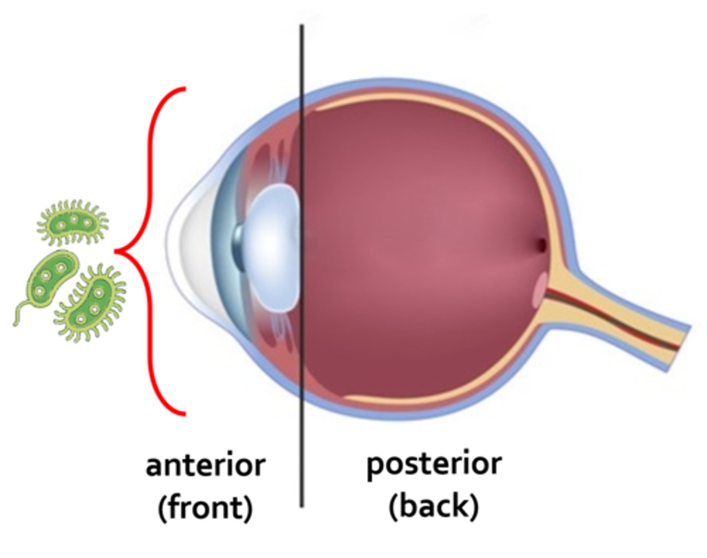 <p>a toxic inflammatory reaction that results from contaminants entering the anterior segment (front part) of the eye during eye surgery</p>