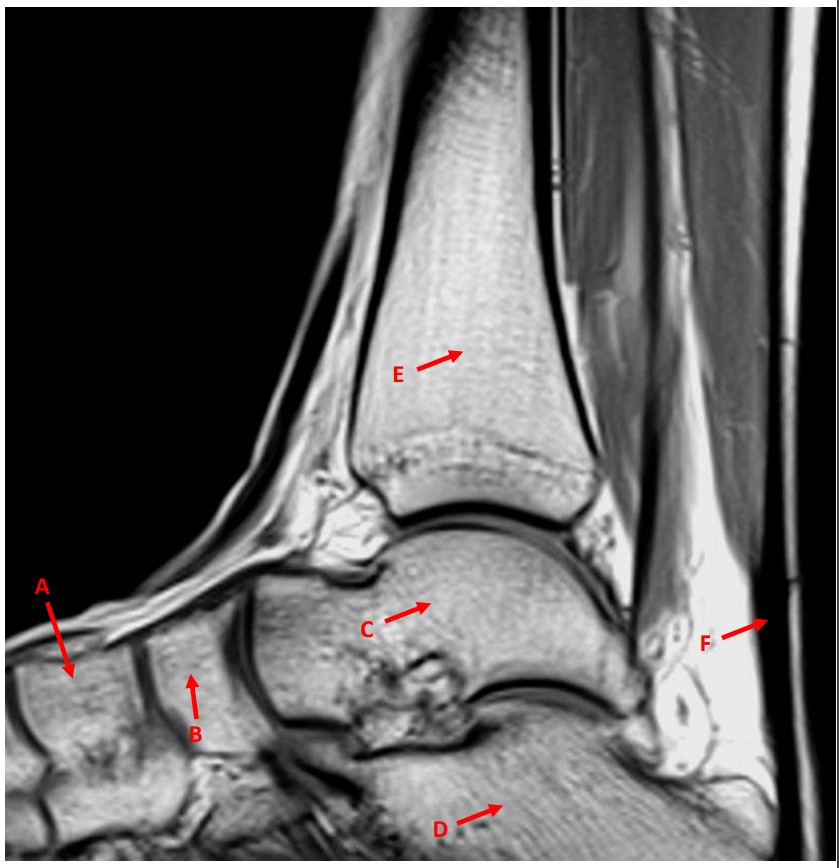 <p>E</p>
