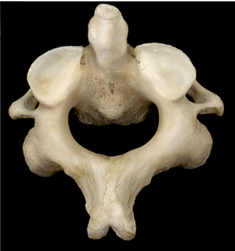 <p>what vertebrae is this</p>
