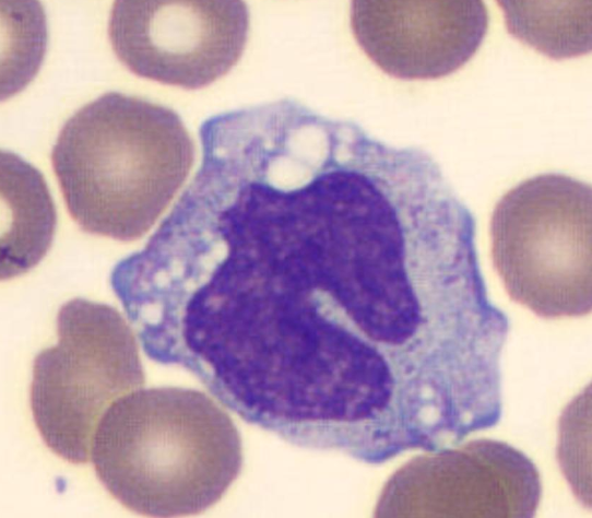 term image