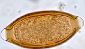 <p> </p><p>List the egg TYPE for the nematode egg shown.</p>