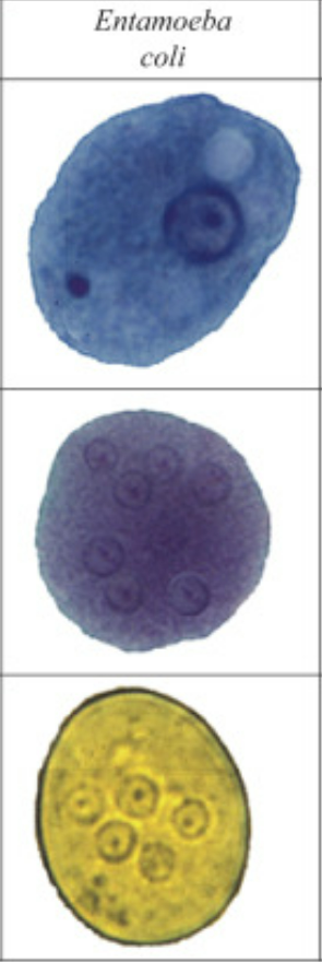 <p>Entamoeba coli</p>