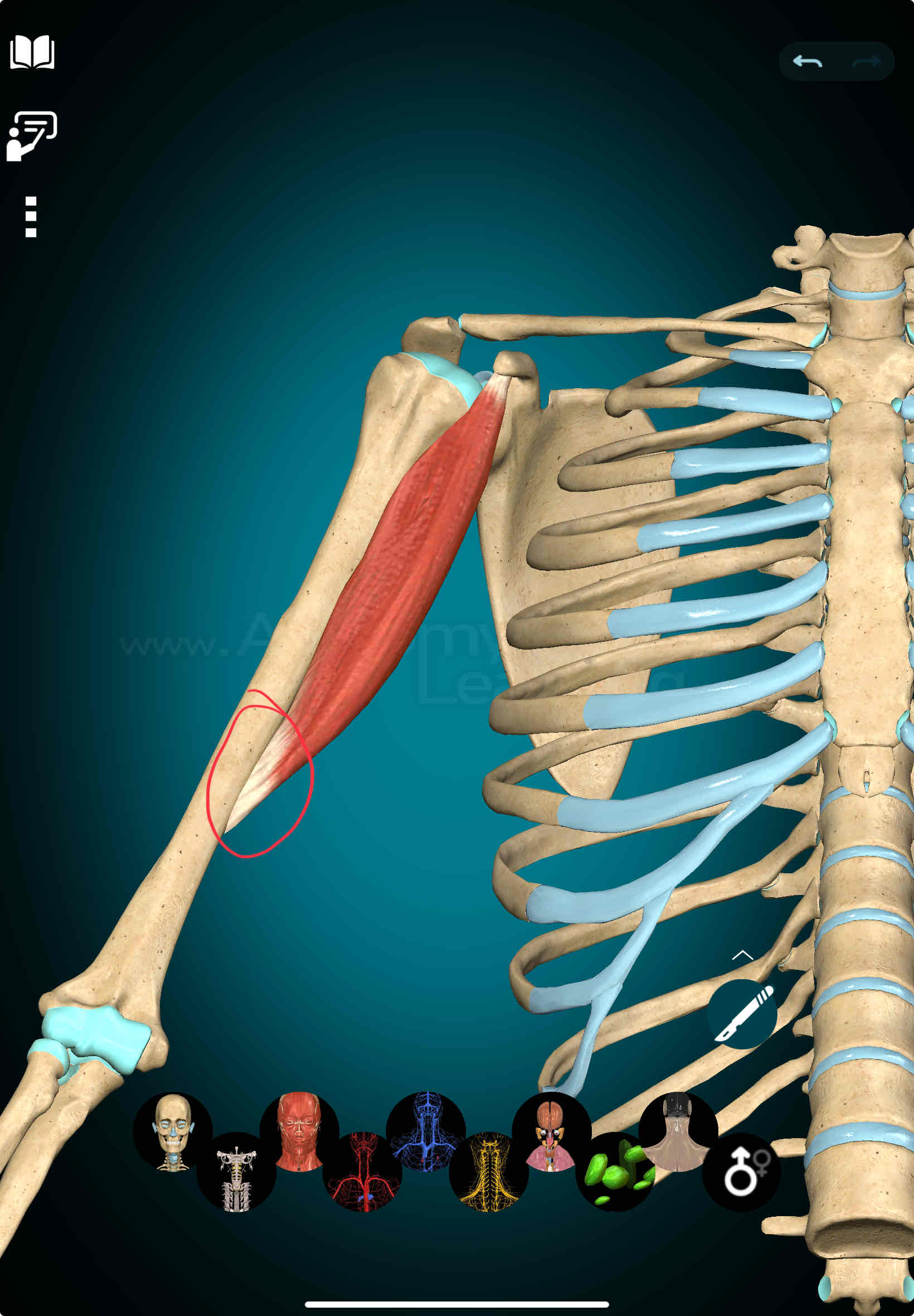 <p>Coracobrachialis Insertion</p>