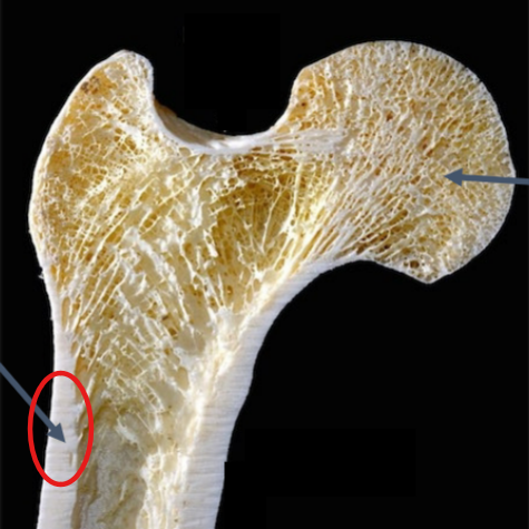 <p>Smooth bone found <strong>outside</strong> of long / flat / irregular bones</p>