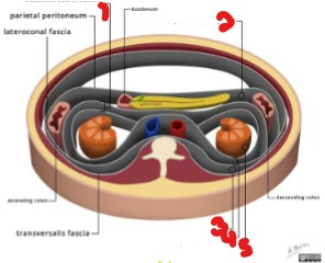 <p>Label the renal spaces/fascia seen here. </p>