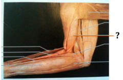 <p>anterior upper arm, Forearm flexion</p>