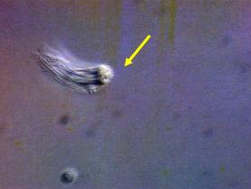 <p>Identify the sperm morphology. (bull)</p>