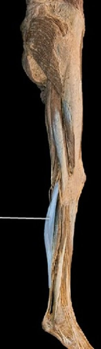 <p>What muscle is this?</p>