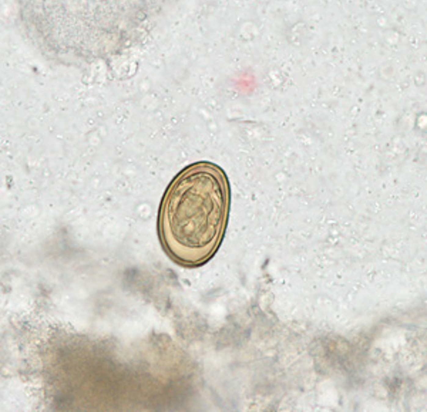 <p><strong>Dicrocoelium dendriticum</strong></p>