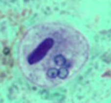 <p>Identify organism and stage</p>