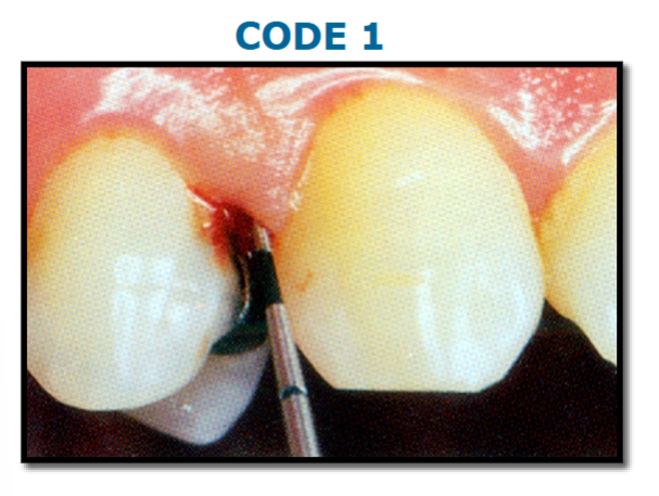 <p>colored area of probe completely visible, BOP</p>