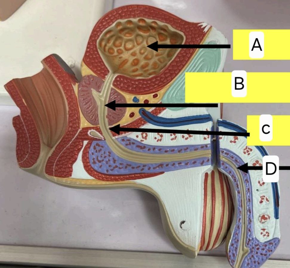 <p>Identify the following and answer these questions </p><p></p><ul><li><p>mention the length of the urethra </p></li></ul><p></p><p>A question asking to enumerate urethra parts can be asked with this model</p><p></p>