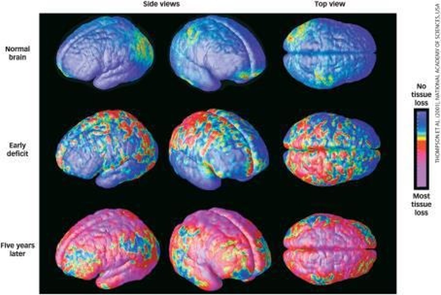 <p>It may affect the development and recovery of the disorder.</p>