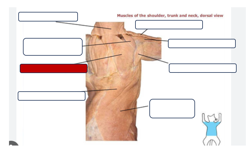 <p>Label the muscle</p>