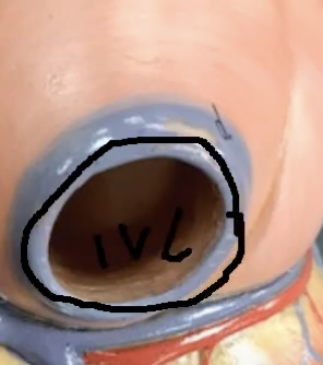 <p>What is this…</p>