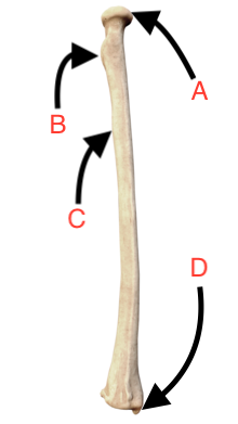 <p>What is the name of this bone?</p>