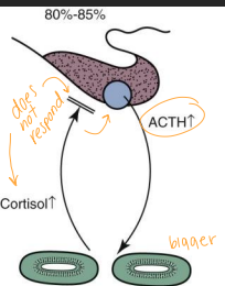 <ul><li><p><span style="background-color: transparent;"><strong>Et: </strong></span></p><ul><li><p><span style="background-color: transparent;"><strong><u>2ndary PDH: </u></strong></span><span style="background-color: transparent; color: red;"><u>fxnal pituitary tumor, </u><strong><u>bilatera</u></strong><u>l adrenal hyperplasia → pumping ACTH</u></span></p><ul><li><p><span style="background-color: transparent;"><strong>Adenoma</strong>: micro (<3mm) > macro (>10mm)</span></p><ul><li><p>pars distalis – >70% of dogs</p></li></ul></li></ul></li><li><p><span style="background-color: transparent;"><strong><u>primary FAT:</u></strong></span><span style="background-color: transparent; color: red;"><strong><u> </u></strong><u>fxnal adrenal tumor, </u><strong><u>unilateral shrinkage</u></strong><u>, 50% malignant → pumping cortisol</u></span></p></li><li><p><span style="background-color: transparent;"><strong>Iatrogenic:</strong> chronic steroids, large dogs</span></p></li></ul></li><li><p><span style="background-color: transparent;"><strong>Cs:</strong> </span><span style="background-color: transparent; color: red;"><strong><u>PU/PD, polyphagia, pot-belly, alopecia, thin skin, panting, infections, calcification of skin, Thromboembolism, renal DZ</u></strong></span></p></li><li><p><span style="background-color: transparent;"><strong>Dt: </strong></span><span style="background-color: transparent; color: purple;"><strong>LDDST</strong></span><span style="background-color: transparent;"> (#1, PDH), </span><span style="background-color: transparent; color: purple;"><strong>ACTH stim test</strong> </span><span style="background-color: transparent;">(iatrogenic, HAC or monitoring), </span><span style="background-color: transparent; color: purple;"><strong>Urine cortisol:Cr</strong> </span><span style="background-color: transparent;">(rule out only!), </span><span style="background-color: transparent; color: purple;"><strong>Endogenous ACTH</strong></span><span style="background-color: transparent;"> (PDH vs FAT)</span></p><ul><li><p>CBC: stress, ↑↑ ALP & cholesterol, UA:1.008-1.025 dilute/proteinuria</p><ul><li><p><span style="background-color: transparent;"><strong>Ddx: </strong></span><span style="background-color: transparent; color: purple;"><strong>stress, chronic adrenal dz</strong></span></p></li><li><p><span style="background-color: transparent;"><strong><u>FAT not responsive to ACTH or LDDST</u></strong></span></p></li></ul></li></ul></li></ul><ul><li><p><span style="background-color: transparent;"><strong>Tx: <u>monitor at 2w +4w + q 3-6m</u></strong> with biochem, CBC, <strong><u>ACTH stim or cortisol test </u></strong></span></p><ul><li><p><span style="background-color: transparent;"><strong>PDH: Trilostane</strong>, Ketocazole, <u>Mitotane</u>, Sx</span></p></li><li><p><span style="background-color: transparent;"><strong>FAT: Trilostane,</strong> Mitotane, Sx</span></p></li><li><p><span style="background-color: transparent;"><strong>Iatrogenic: </strong>taper steroids</span></p></li></ul></li></ul><img src="https://knowt-user-attachments.s3.amazonaws.com/bd92178f-4977-43a0-91a7-8fd165d279bc.png" data-width="50%" data-align="center"><img src="https://knowt-user-attachments.s3.amazonaws.com/10f7e92d-00bc-4e43-b7cb-ae5dc9586a6a.png" data-width="50%" data-align="center" alt="LARGE liver"><p></p>