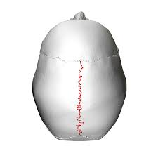 <p>What suture is this?</p>