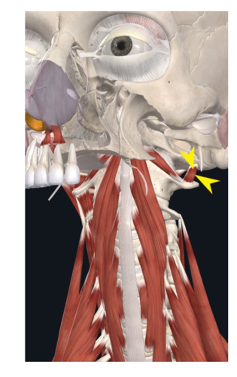 <p>What is this muscle?</p>