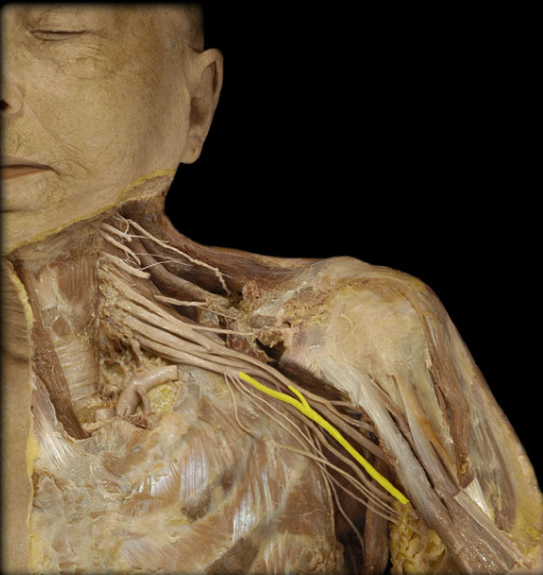 name this plexus and nerve