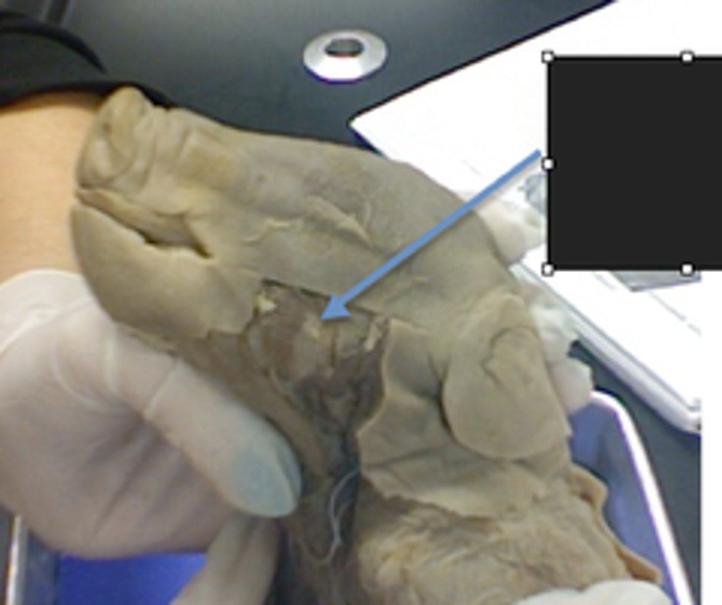 <p>name this structure that runs out of this gland</p>