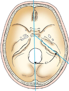 <p>typical skull; petrous pyramids project anteriorly and medially at 47-degree angle from MSP</p>