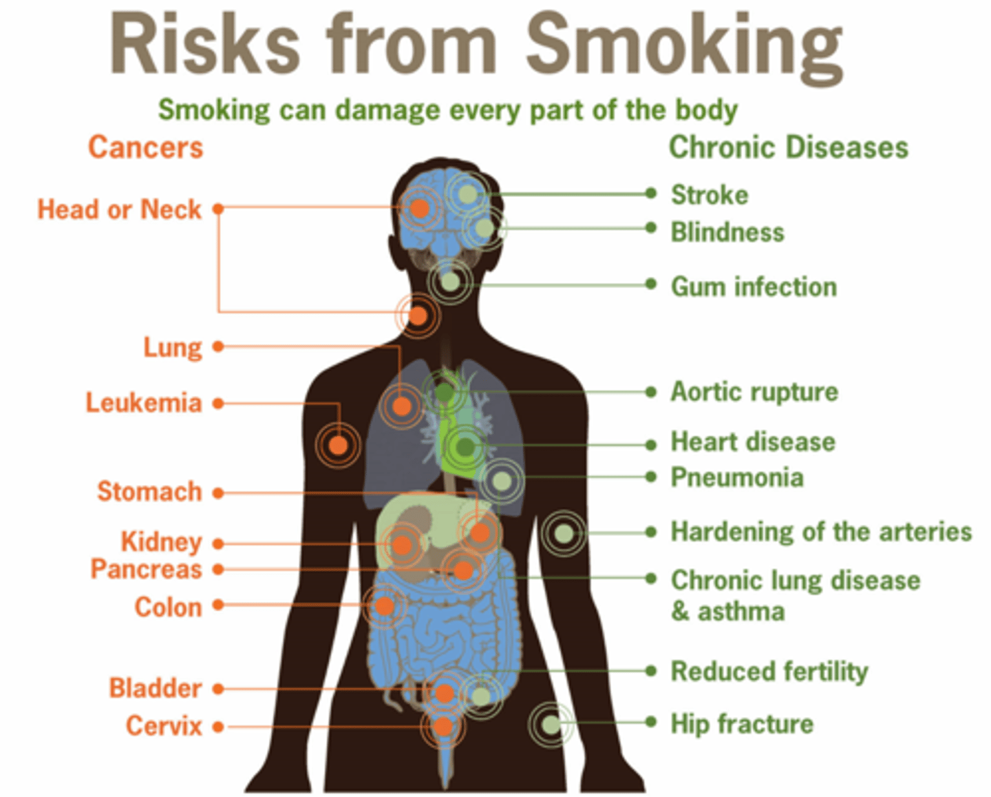 <p>A. CORRECT. A history of smoking is a risk factor for coronary artery disease.</p><p>B. Being underweight is not a risk factor for coronary artery disease. Excess body fat is a risk factor.</p><p>C. HDL Cholesterol is considered good cholesterol. High LDL levels are a risk factor for developing coronary artery disease.</p><p>D. Cellulitis is an inflammation of the cellular or connective tissue and is not a risk factor of coronary artery disease.</p>