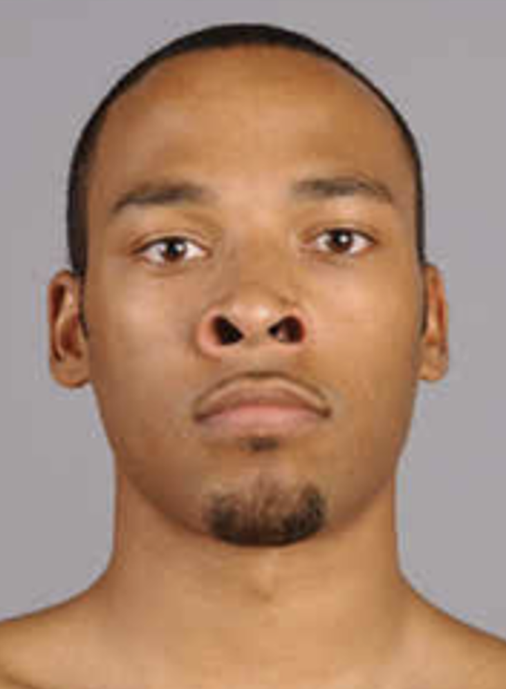<p>are muscles that elevate the upper lip and flare the nostrils, contributing to facial expression and expressions of disdain or disbelief. </p>