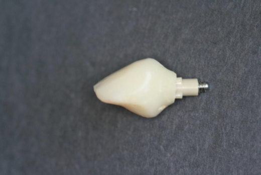 <p>steps to successfully fabricate a provisional implant restoration </p>