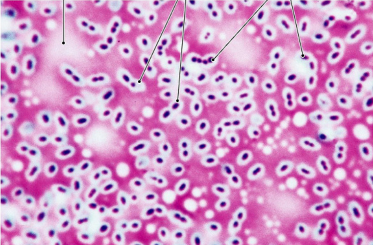 <p>Explain Capsule Stain Technique </p>