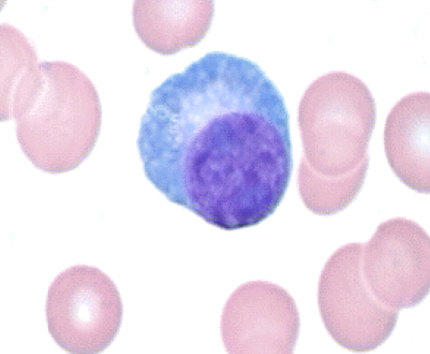 <p>Type of lymphocytes with eccentric (off to the side) nucleus </p>