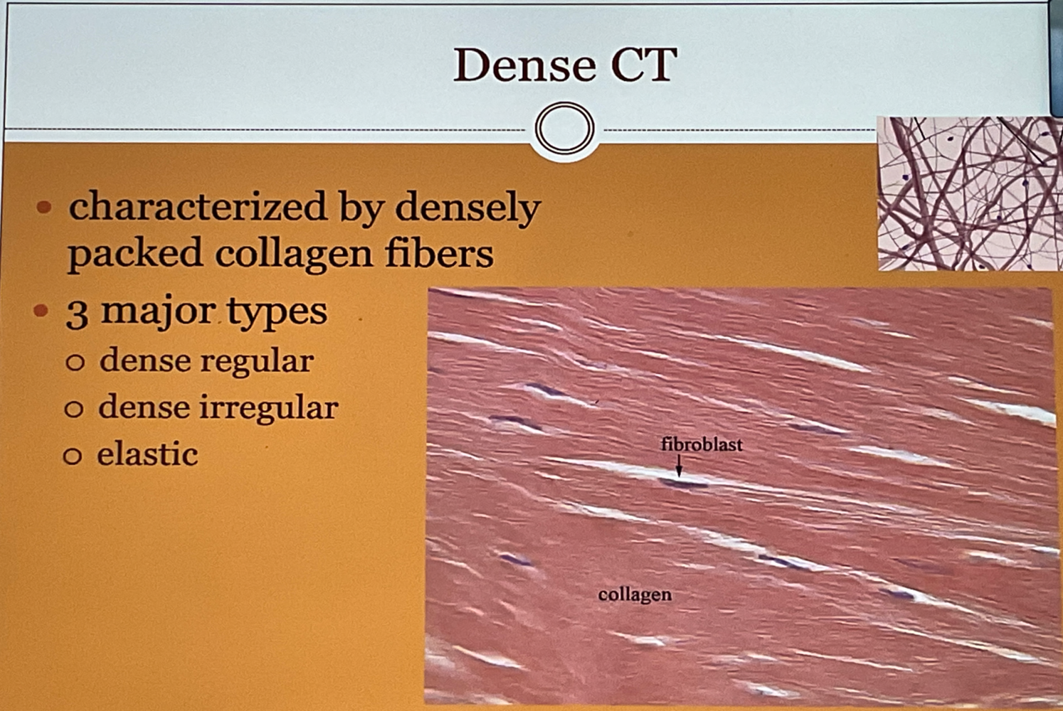 Dense CT 