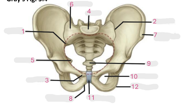 <p>Where is the ischial tuberosity</p>