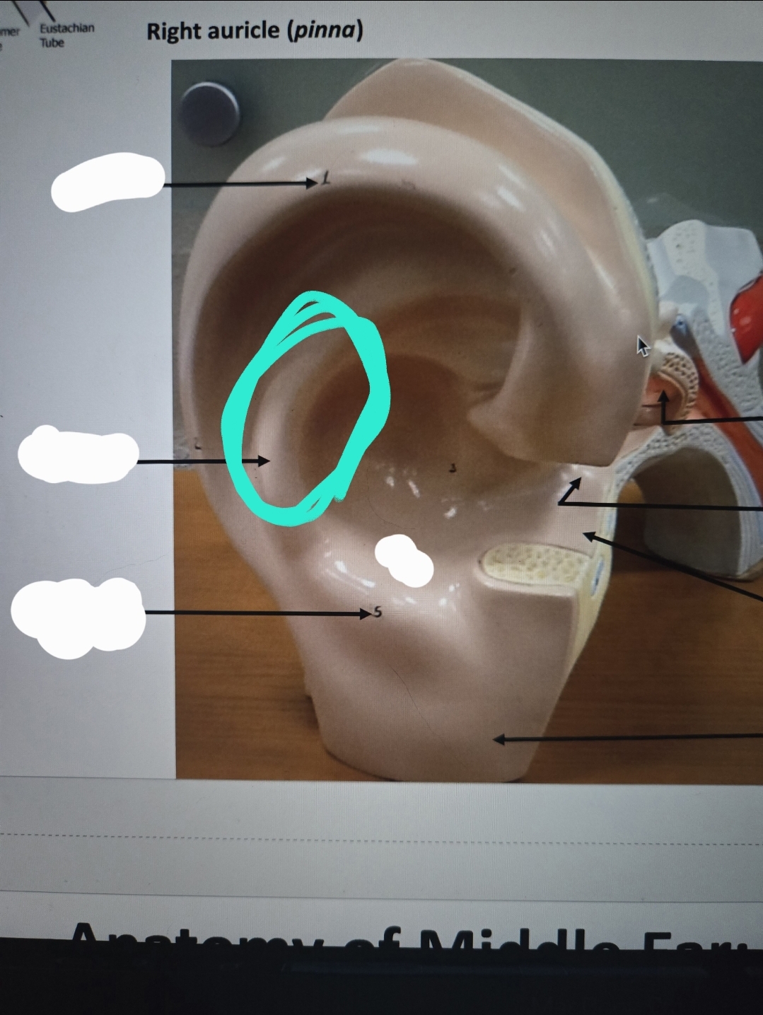 <p>Anatomy of the ear</p>