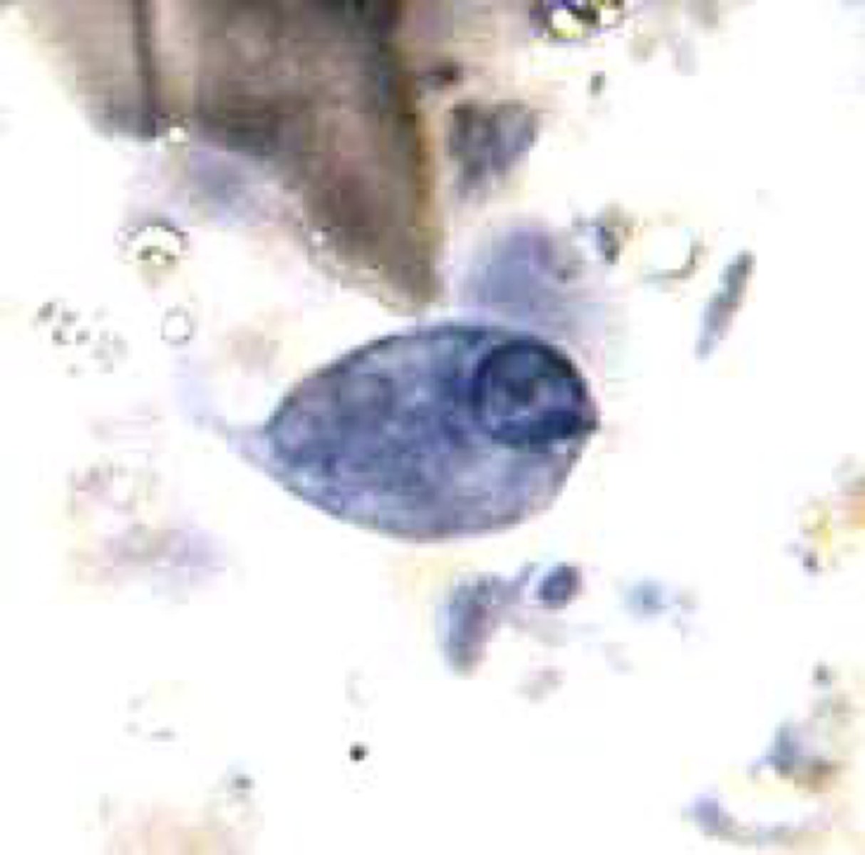 <p>Name the stage and species</p>