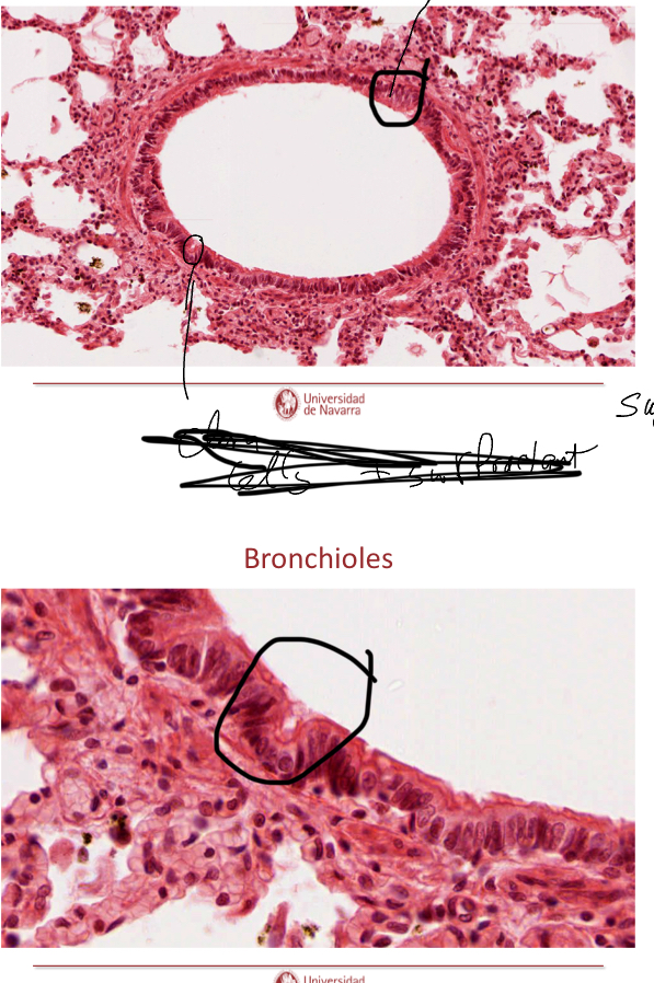 <p>What is circled in the image?</p>