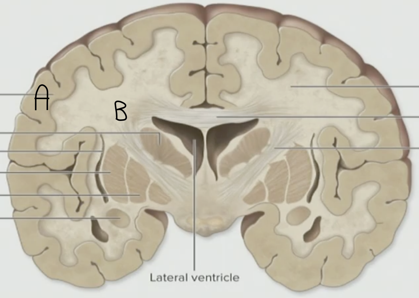 <p>Which is the White Matter, A or B</p>