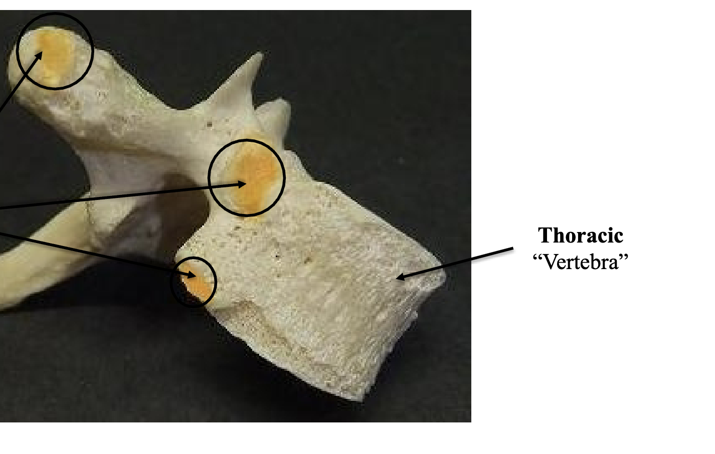 <p>Thoracic Vertebra </p>