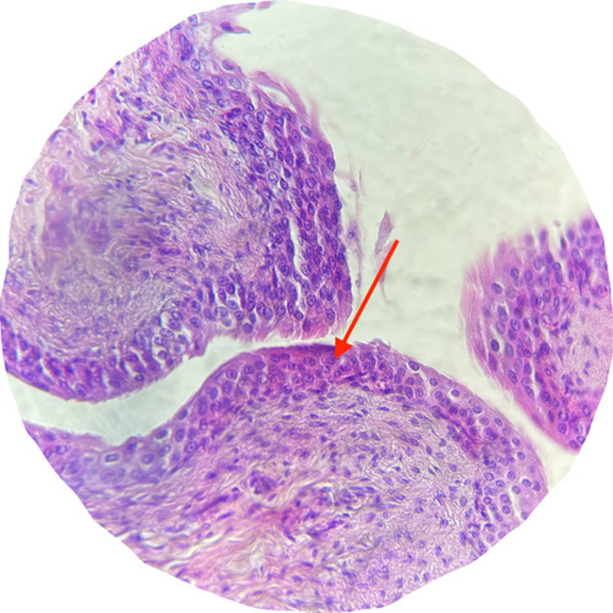 <p>this is a sample of the urinary bladder. what type of epithelial lining is there? is this part contracted or relaxed?</p>