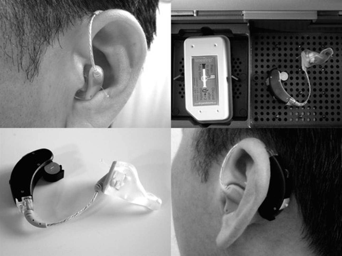 <p>A coiled, bony, fluid-filled tude in the inner ear through which sound waves trigger nerve impulses.</p>
