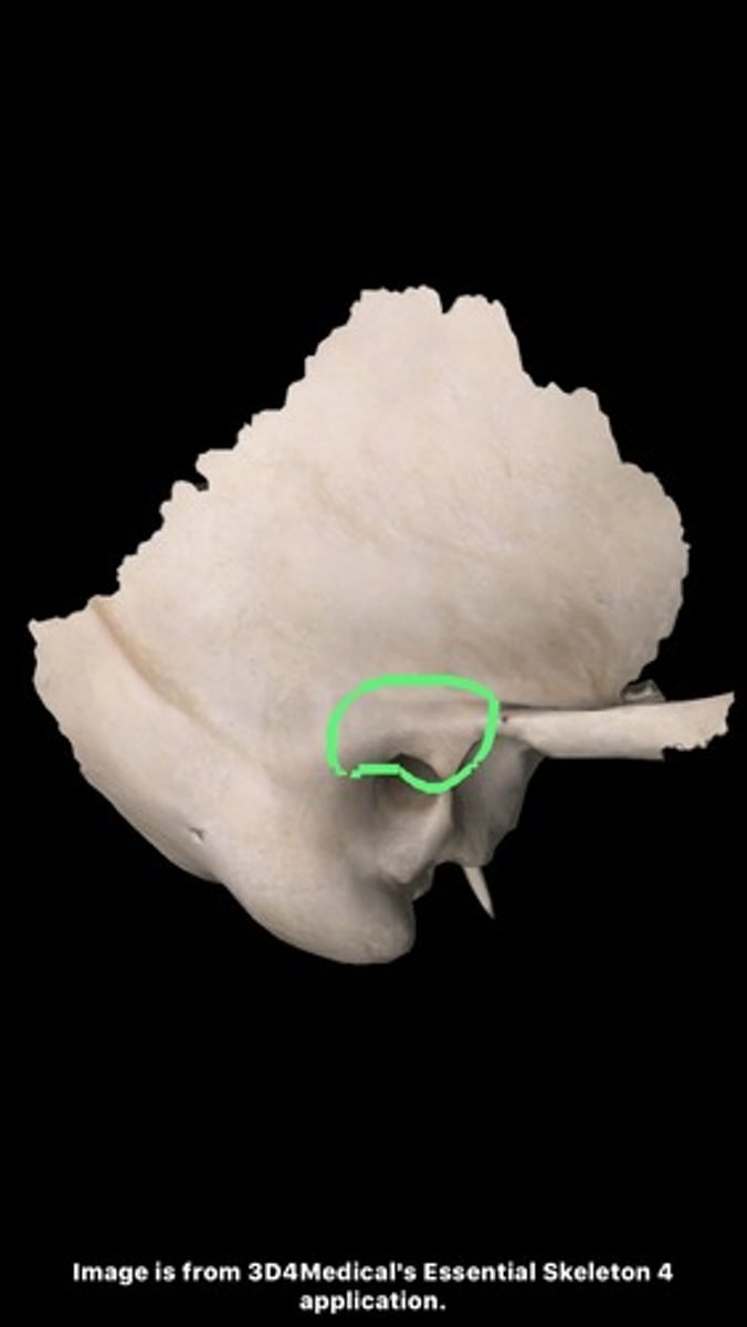 <p>superior root of zygomatic process</p>